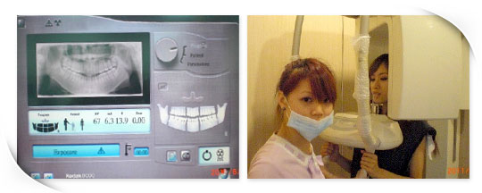 接著照牙齒的X光片，聽醫生說我的牙根很長耶。
